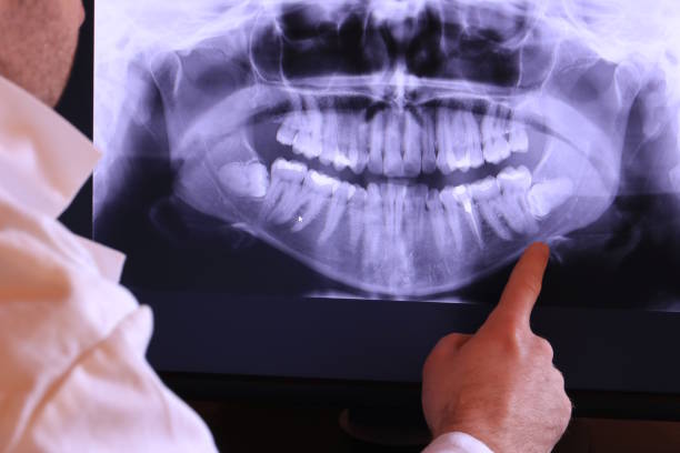 Best Cracked Tooth Emergency Dentist  in Odon, IN